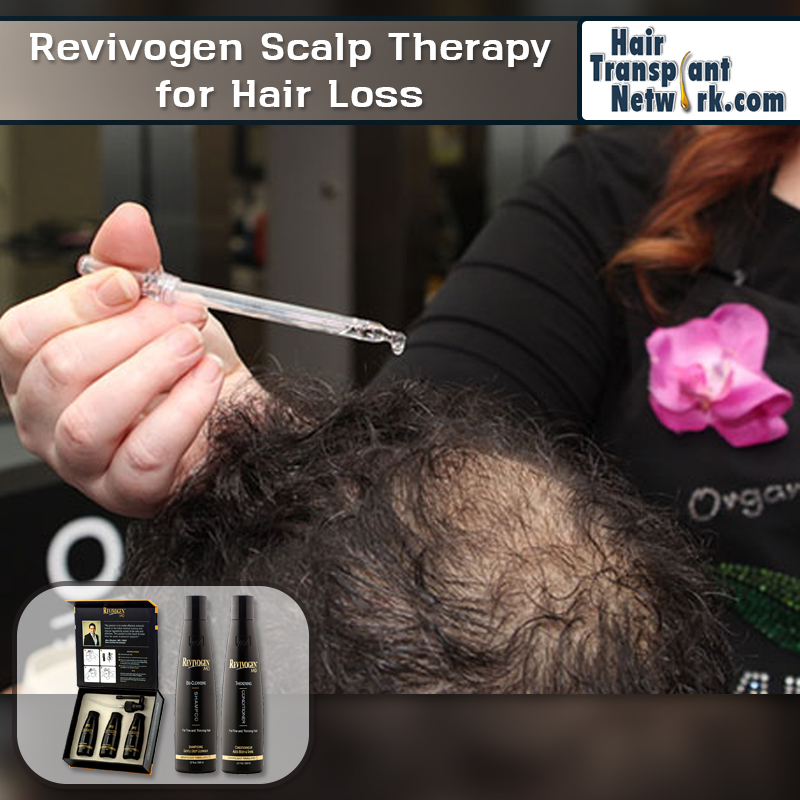 Revivogen Scalp Therapy for Hair Loss