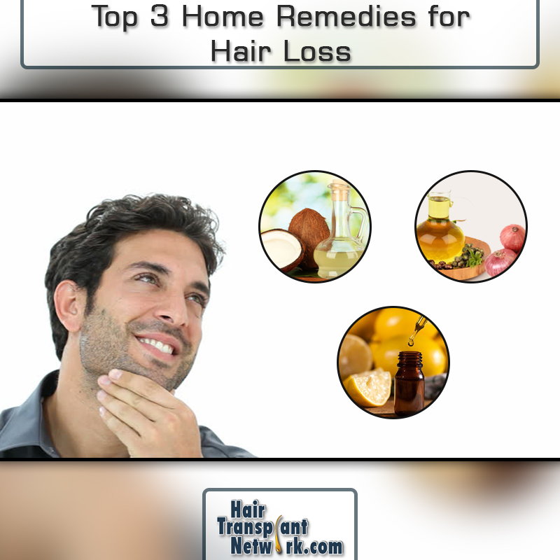 top 3 home remedies for hair loss