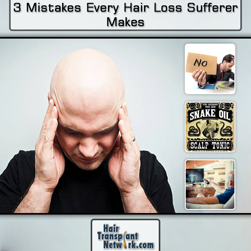 3 Mistakes Every Hair Loss Sufferer Makes